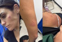 Agreden a alcaldesa Alessandra Rojo de la Vega durante operativo de reordenamiento en San Cosme