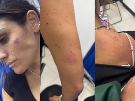 Agreden a alcaldesa Alessandra Rojo de la Vega durante operativo de reordenamiento en San Cosme